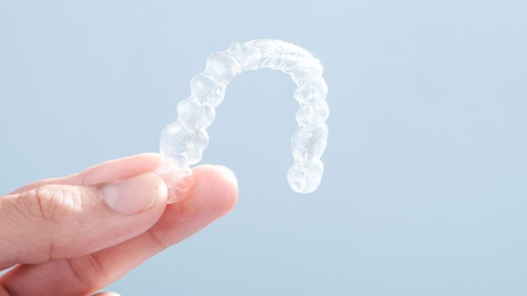 All About Invisalign Treatment
